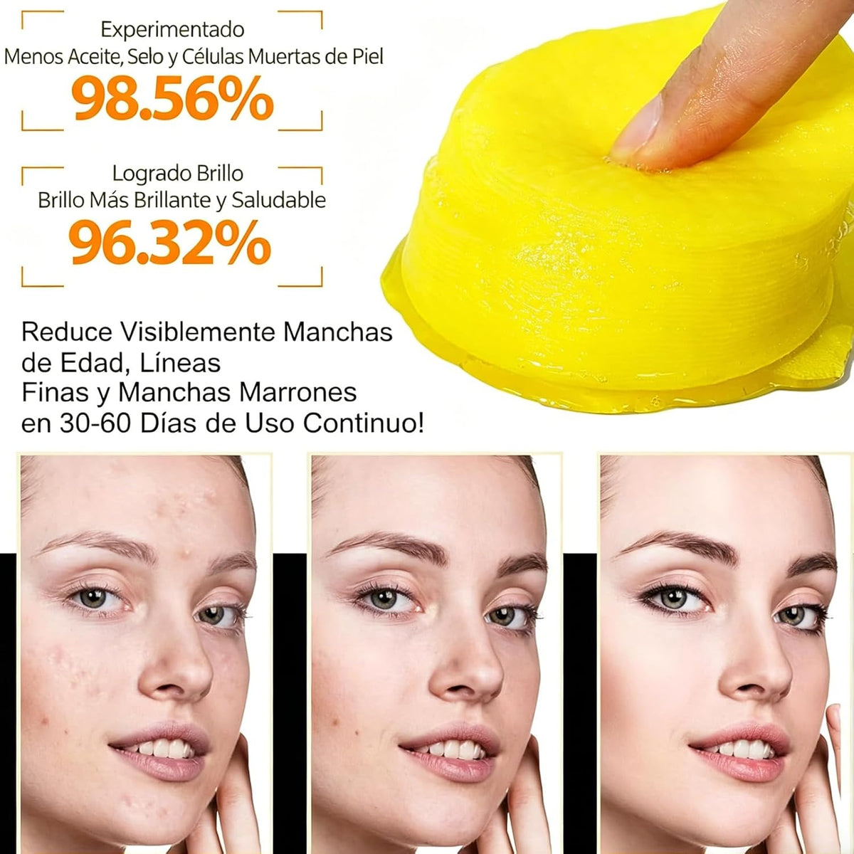 20 Pcs Turmeric & Kojic Acid Cleansing Pads — Deep Pore Cleansing