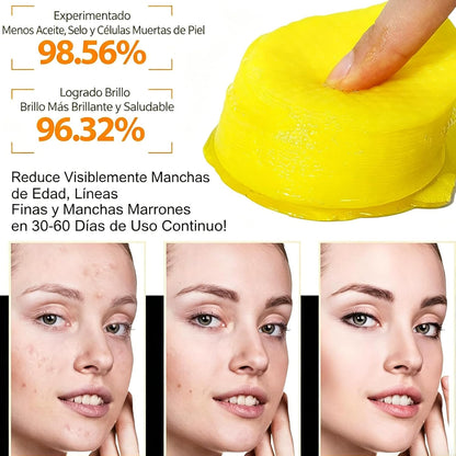 20 Pcs Turmeric & Kojic Acid Cleansing Pads — Deep Pore Cleansing