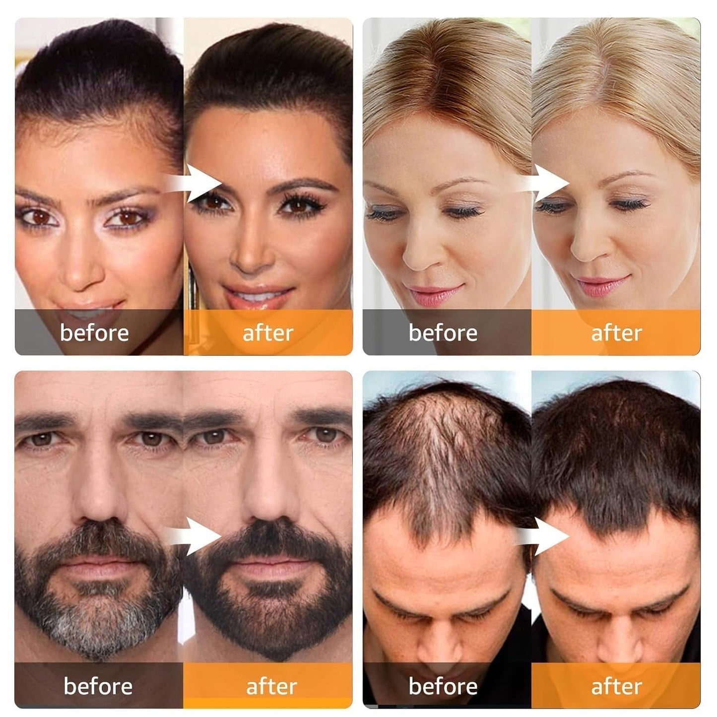 Root Cover Up Hairline Shadow Powder, Touch Up Quickly Conceals Gray Hair