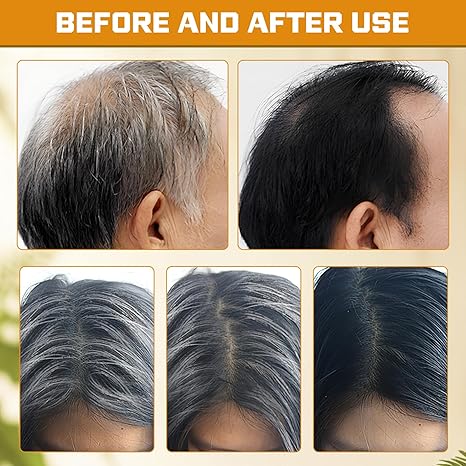 2 PCS Black Hair Soap Bar for Men and Women