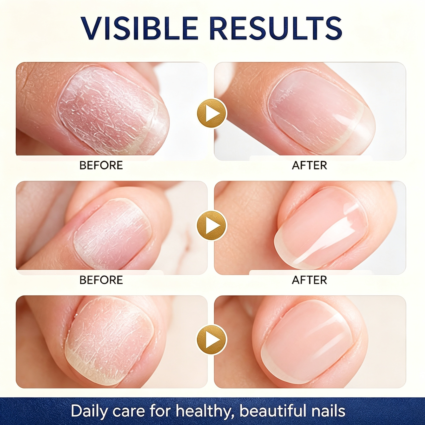 Keratin & Amino Acid Nail Strengthening Oil, Fast Hydration & Repair Treatment for Nail