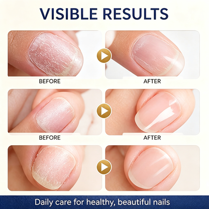 Keratin & Amino Acid Nail Strengthening Oil, Fast Hydration & Repair Treatment for Nail