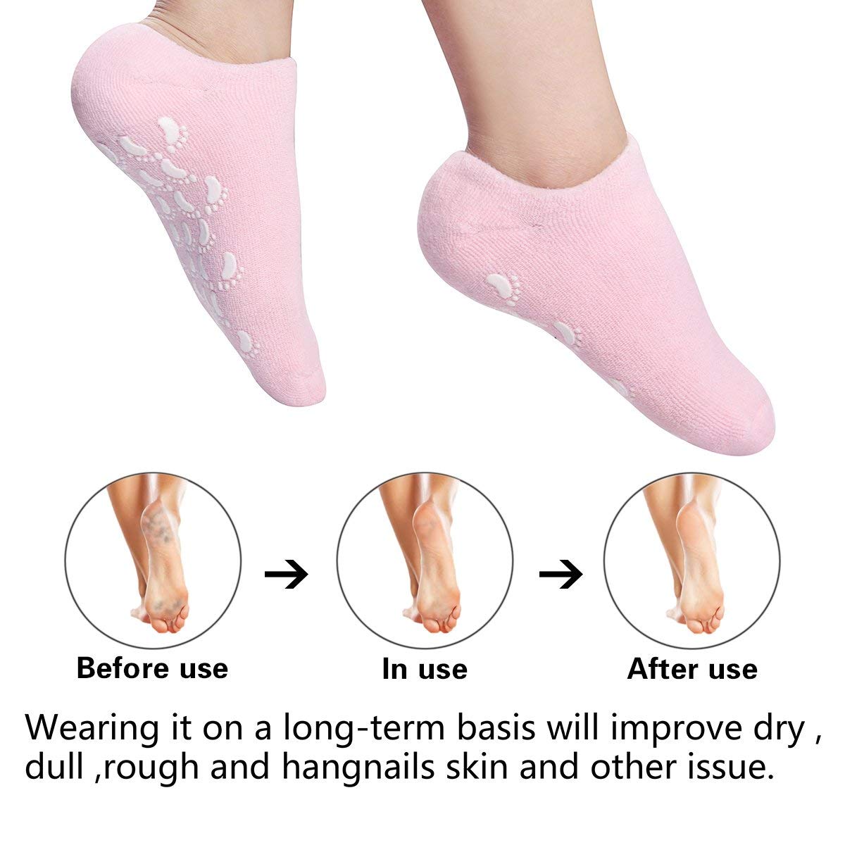 2 Pairs Cotton Gel Sleeves for Repairing Softening Dry Cracked Feet Skins