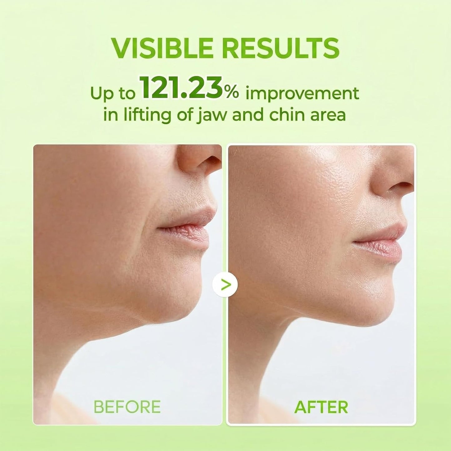 Collagen Double Chin Lifting Band for Sagging Jawline & Facial Puffiness Jaw