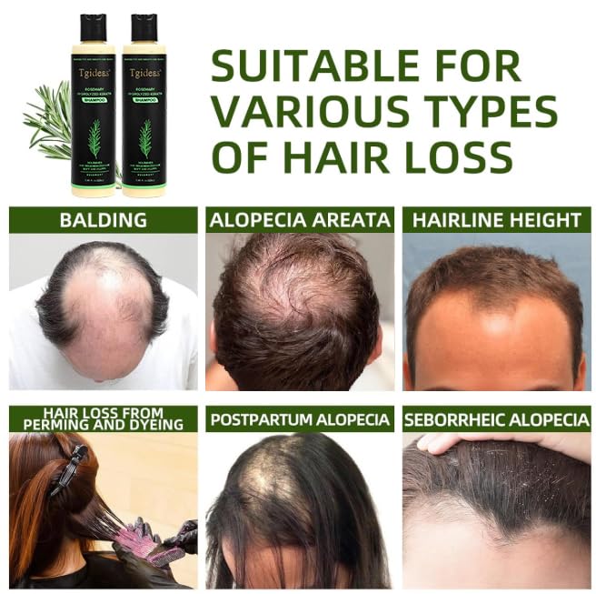 100ml Rosemary & Biotin Volumizing Shampoo for Thinning Hair
