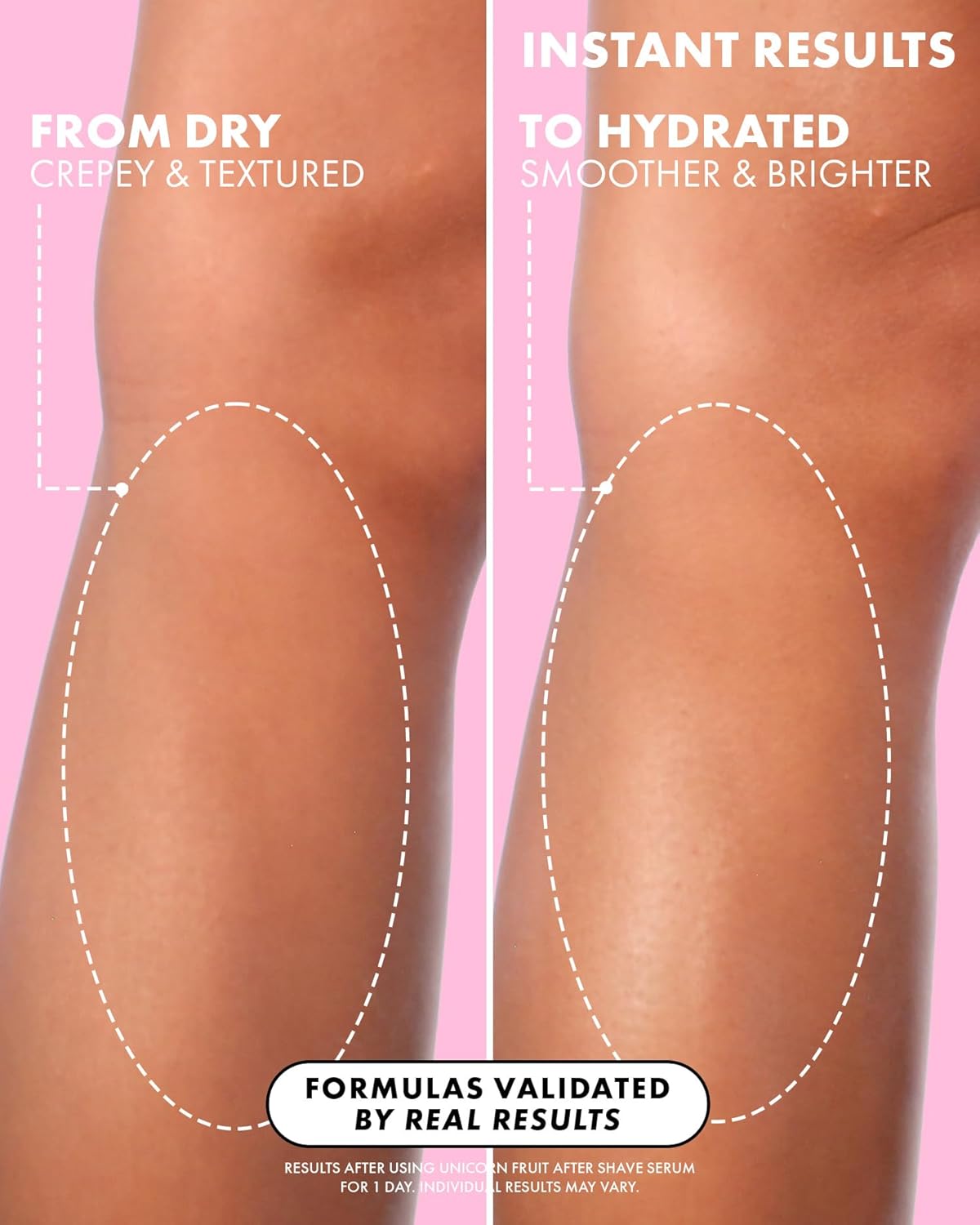Soothing & Hydrating Post Shave Treatment to Prevent Ingrown
