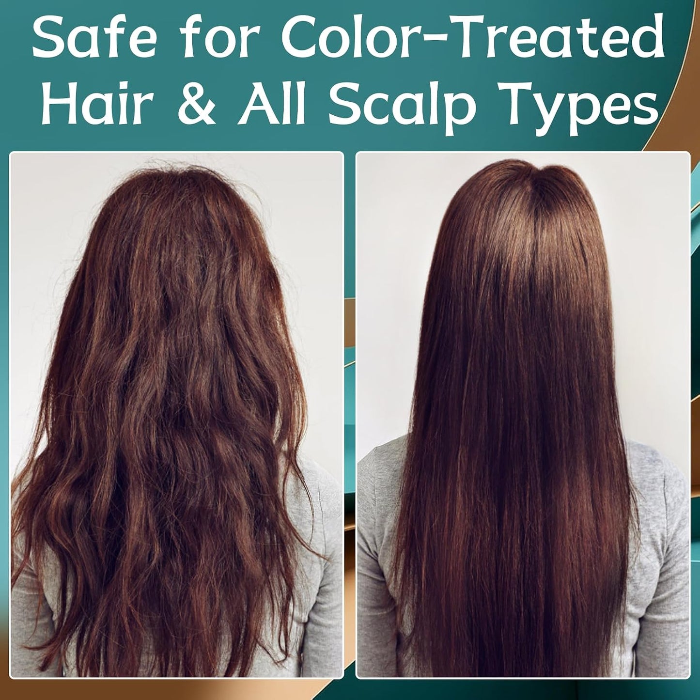 5% Minoxidil Hair Growth Scalp Massage Cream