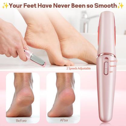 Electric Foot Callus Remover Rechargeable Pedicure Tools