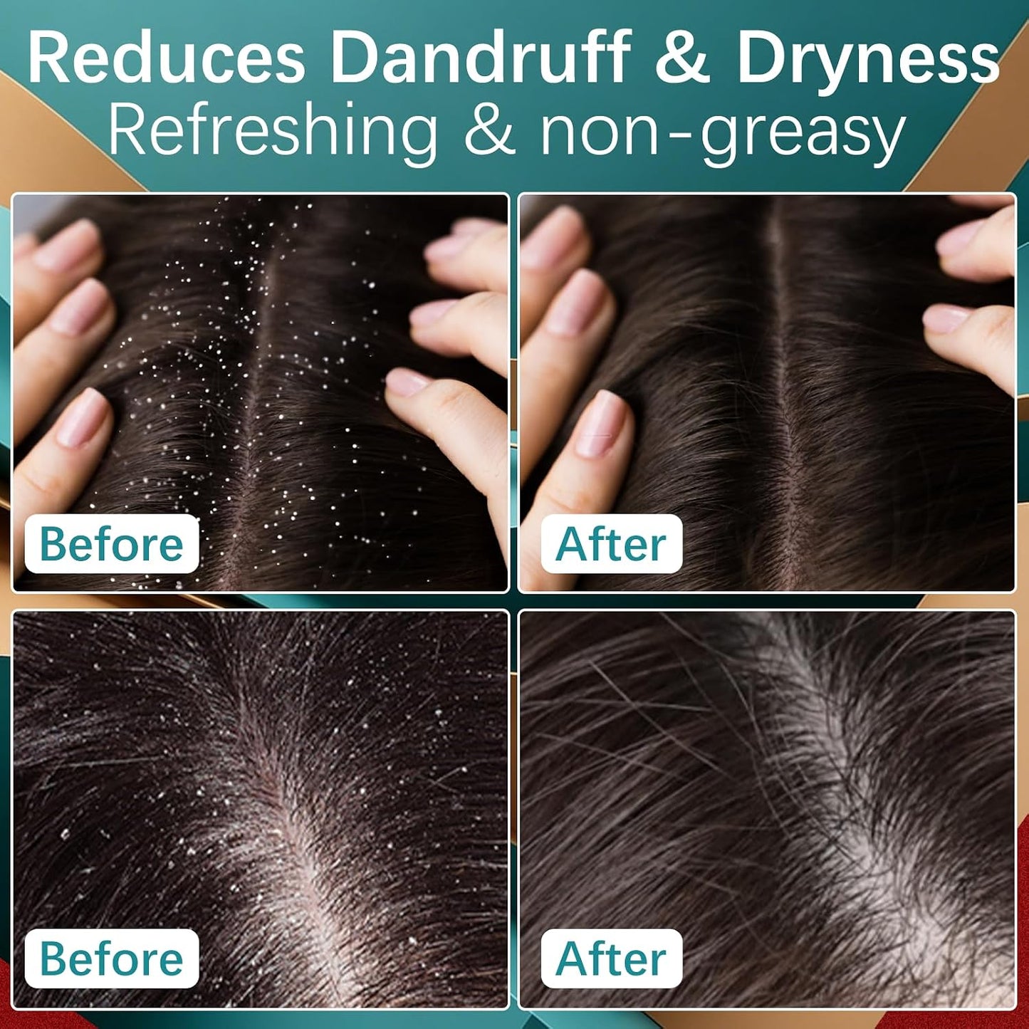 5% Minoxidil Hair Growth Scalp Massage Cream