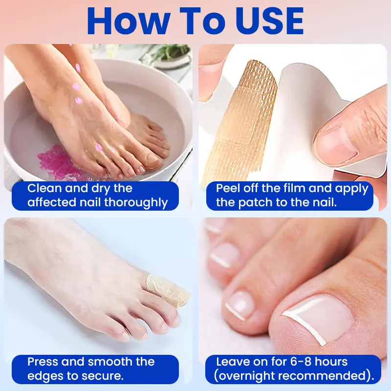 Fungal Nail Patches 21 Patches for Damaged Nails
