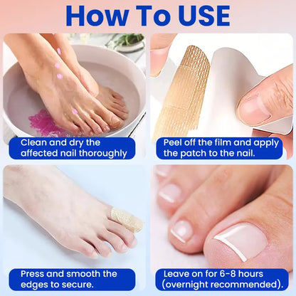 Fungal Nail Patches 21 Patches for Damaged Nails
