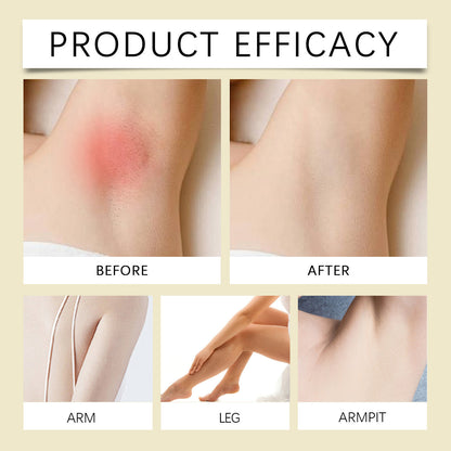 Botanical After Hair Removal Oil with Cyperus Rotundus