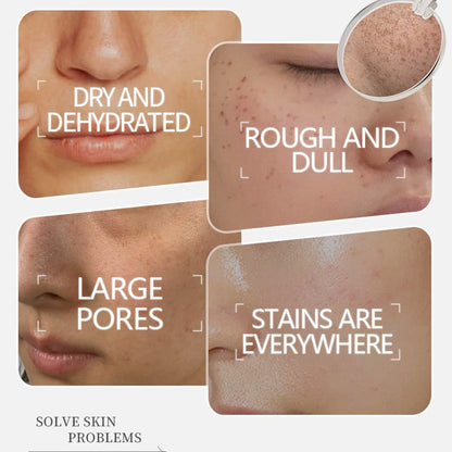30ml Niacinamide Brightening Serum – Hydrating and Moisturizing Facial Care