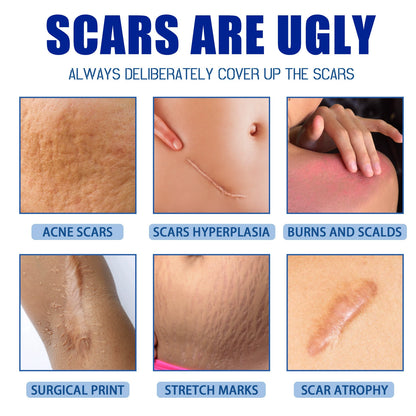 Professional Scar Removal Gels Advanced Silicone Scar Removal Cream