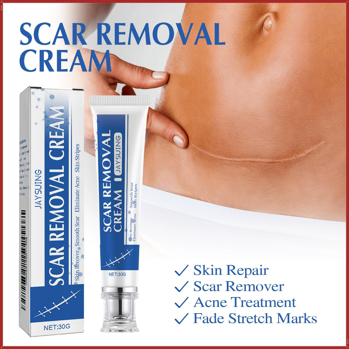 Professional Scar Removal Gels Advanced Silicone Scar Removal Cream
