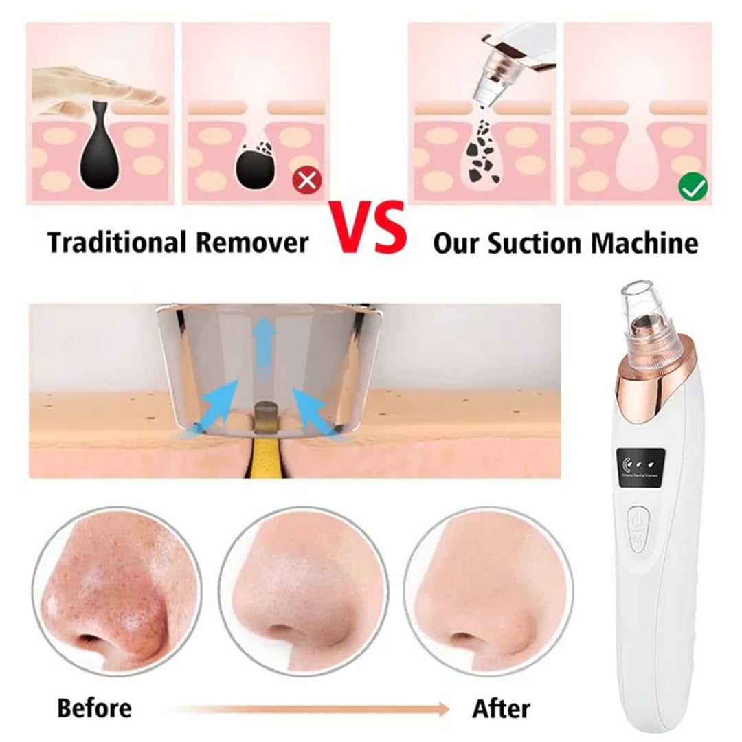 Blackhead Remover Pore Vacuum,Professional Facial Pore Cleaner