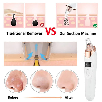 Blackhead Remover Pore Vacuum,Professional Facial Pore Cleaner