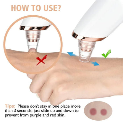 Blackhead Remover Pore Vacuum,Professional Facial Pore Cleaner